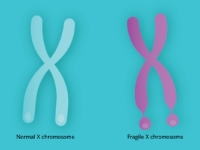 Fragile X İlişkili Primer Over Yetmezliği (FXPOI) Genetiği (Erken yumurtalık yetmezliği)
